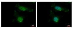 Invitrogen TAOK2 Polyclonal Antibody 100 &mu;L; Unconjugated:Antibodies,