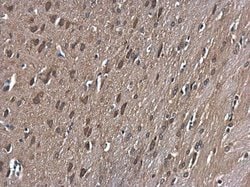 Invitrogen GSK3B Polyclonal Antibody 100 &mu;L; Unconjugated:Antibodies,