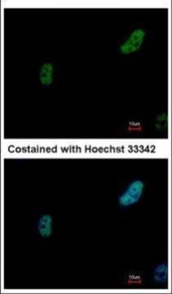 Invitrogen PRP19 Polyclonal Antibody 100 &mu;L; Unconjugated:Antibodies,