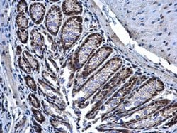 Invitrogen PRP19 Polyclonal Antibody 100 &mu;L; Unconjugated:Antibodies,