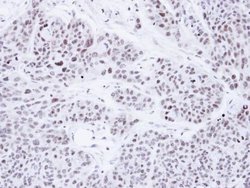 Invitrogen PRP19 Polyclonal Antibody 100 &mu;L; Unconjugated:Antibodies,