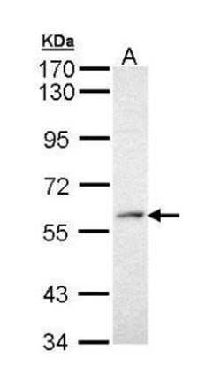 Invitrogen PRP19 Polyclonal Antibody 100 &mu;L; Unconjugated:Antibodies,