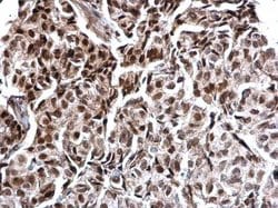 Invitrogen Calcineurin A Polyclonal Antibody 100 &mu;L; Unconjugated:Antibodies,