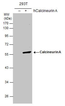 Invitrogen Calcineurin A Polyclonal Antibody 100 &mu;L; Unconjugated:Antibodies,