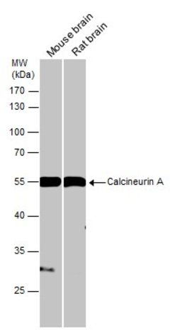 Invitrogen Calcineurin A Polyclonal Antibody 100 &mu;L; Unconjugated:Antibodies,