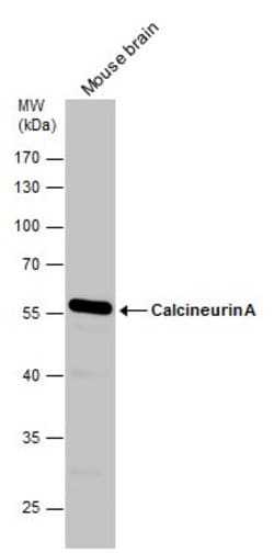 Invitrogen Calcineurin A Polyclonal Antibody 100 &mu;L; Unconjugated:Antibodies,