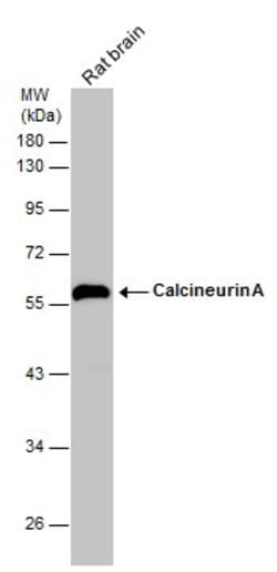 Invitrogen Calcineurin A Polyclonal Antibody 100 &mu;L; Unconjugated:Antibodies,