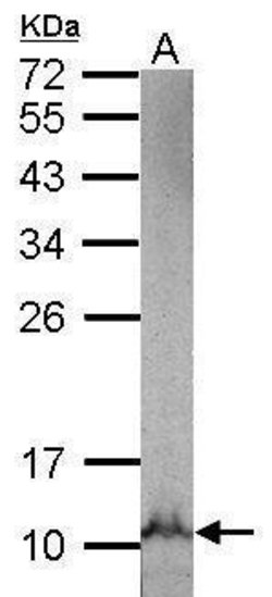 Invitrogen NDUFB3 Polyclonal Antibody 100 &mu;L | Buy Online | Invitrogen&trade; | Fisher Scientific