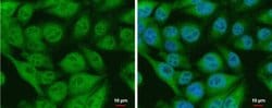 Invitrogen CIAPIN1 Polyclonal Antibody 100 μL; Unconjugated:Antibodies,