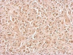 Invitrogen CIAPIN1 Polyclonal Antibody 100 μL; Unconjugated:Antibodies,