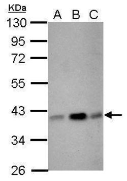 Invitrogen CIAPIN1 Polyclonal Antibody 100 μL; Unconjugated:Antibodies,