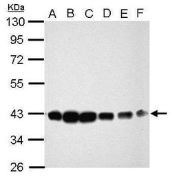 Invitrogen CIAPIN1 Polyclonal Antibody 100 μL; Unconjugated:Antibodies,