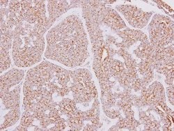 Invitrogen CARD10 Polyclonal Antibody 100 &mu;L; Unconjugated:Antibodies,