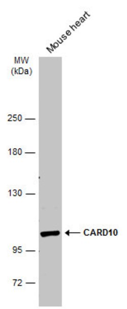 Invitrogen CARD10 Polyclonal Antibody 100 &mu;L; Unconjugated:Antibodies,