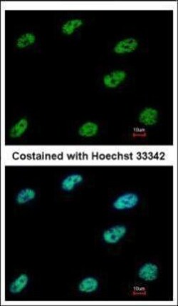 Invitrogen CtBP1 Polyclonal Antibody 100 &mu;L | Buy Online | Invitrogen&trade; | Fisher Scientific