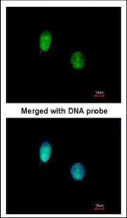 Invitrogen CtBP1 Polyclonal Antibody 100 &mu;L; Unconjugated:Antibodies,