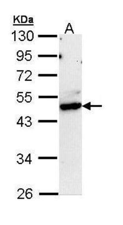 Invitrogen CtBP1 Polyclonal Antibody 100 &mu;L; Unconjugated:Antibodies,