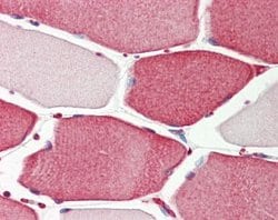 Invitrogen APIP Polyclonal Antibody 100 &mu;L; Unconjugated:Antibodies,