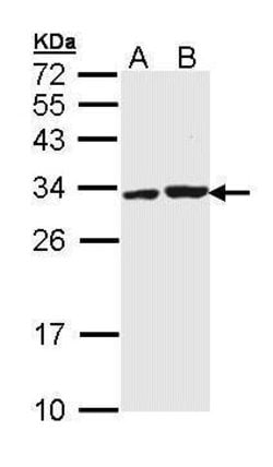Invitrogen APIP Polyclonal Antibody 100 &mu;L; Unconjugated:Antibodies,