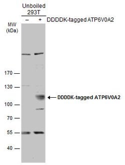 Invitrogen ATP6V0A2 Polyclonal Antibody 100 &mu;L; Unconjugated:Antibodies,