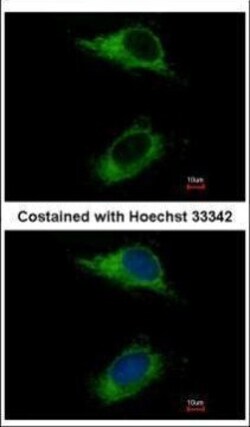 Invitrogen CARD6 Polyclonal Antibody 100 &mu;L | Buy Online | Invitrogen&trade; | Fisher Scientific