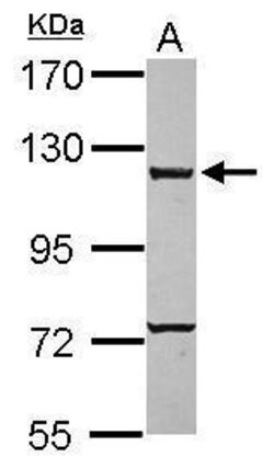 Invitrogen CARD6 Polyclonal Antibody 100 &mu;L | Buy Online | Invitrogen&trade; | Fisher Scientific