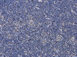 Invitrogen P2X7 Polyclonal Antibody 100 μL; Unconjugated:Antibodies,