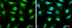 Invitrogen RUVBL1 Polyclonal Antibody 100 &mu;L | Buy Online | Invitrogen&trade; | Fisher Scientific
