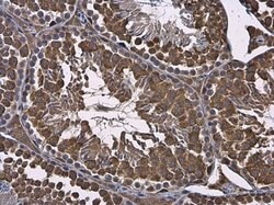 Invitrogen RUVBL1 Polyclonal Antibody 100 &mu;L | Buy Online | Invitrogen&trade; | Fisher Scientific