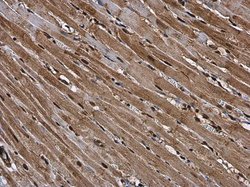 Invitrogen RUVBL1 Polyclonal Antibody 100 &mu;L | Buy Online | Invitrogen&trade; | Fisher Scientific
