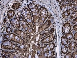 Invitrogen RUVBL1 Polyclonal Antibody 100 &mu;L | Buy Online | Invitrogen&trade; | Fisher Scientific