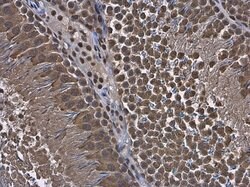 Invitrogen RUVBL1 Polyclonal Antibody 100 &mu;L | Buy Online | Invitrogen&trade; | Fisher Scientific