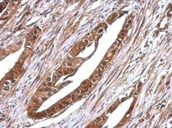 Invitrogen RUVBL1 Polyclonal Antibody 100 &mu;L | Buy Online | Invitrogen&trade; | Fisher Scientific