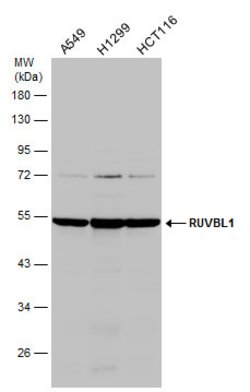 Invitrogen RUVBL1 Polyclonal Antibody 100 &mu;L | Buy Online | Invitrogen&trade; | Fisher Scientific