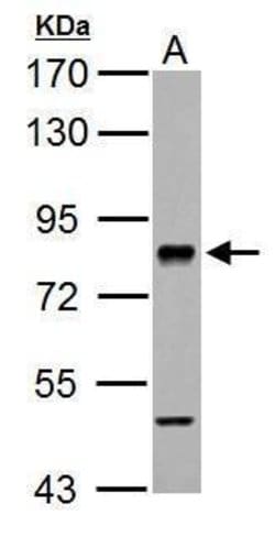 Invitrogen RSK2 Polyclonal Antibody 100 &mu;L; Unconjugated:Antibodies,