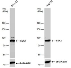 Invitrogen RSK2 Polyclonal Antibody 100 &mu;L; Unconjugated:Antibodies,