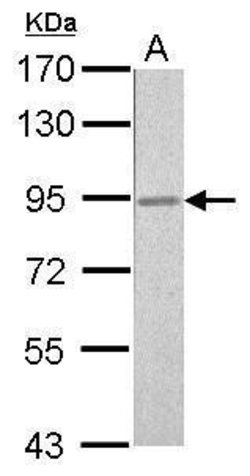 Invitrogen RSK2 Polyclonal Antibody 100 &mu;L; Unconjugated:Antibodies,