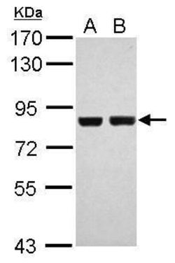 Invitrogen RSK2 Polyclonal Antibody 100 &mu;L; Unconjugated:Antibodies,