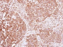 Invitrogen INSR Polyclonal Antibody 100 &mu;L; Unconjugated:Antibodies,