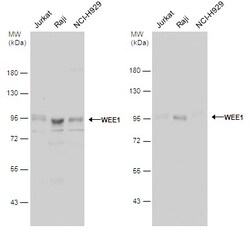 Invitrogen WEE1 Polyclonal Antibody 100 &mu;L; Unconjugated:Antibodies,