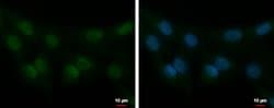 Invitrogen STK40 Polyclonal Antibody 100 &mu;L | Buy Online | Invitrogen&trade; | Fisher Scientific