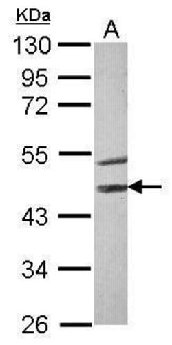 Invitrogen STK40 Polyclonal Antibody 100 &mu;L | Buy Online | Invitrogen&trade; | Fisher Scientific