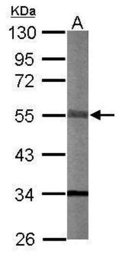 Invitrogen STK40 Polyclonal Antibody 100 &mu;L | Buy Online | Invitrogen&trade; | Fisher Scientific