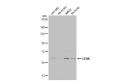 Invitrogen CERK Polyclonal Antibody 100 &mu;L; Unconjugated:Antibodies,