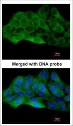Invitrogen ZAK Polyclonal Antibody 100 μL; Unconjugated:Antibodies,