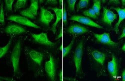 Invitrogen HK2 Polyclonal Antibody 100 &mu;L; Unconjugated:Antibodies,
