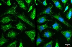 Invitrogen HK2 Polyclonal Antibody 100 &mu;L; Unconjugated:Antibodies,