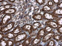 Invitrogen HK2 Polyclonal Antibody 100 &mu;L; Unconjugated:Antibodies,