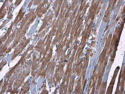 Invitrogen HK2 Polyclonal Antibody 100 &mu;L; Unconjugated:Antibodies,