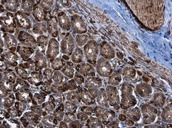Invitrogen HK2 Polyclonal Antibody 100 &mu;L; Unconjugated:Antibodies,